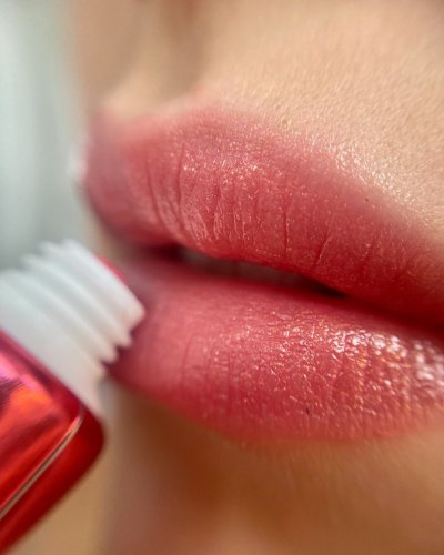 Solutions to Kiss Chapped Lips Goodbye
