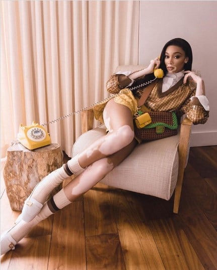 Talent in Fashion Speaks Louder than Racism
